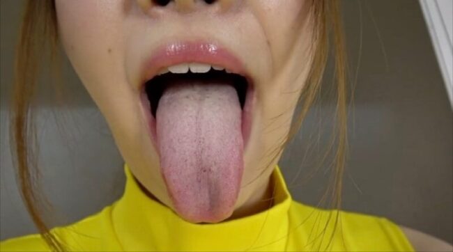 若月みいなの舌苔まみれの汚舌